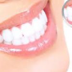 Scopri subito come avere denti più sani e un sorriso più bianco.